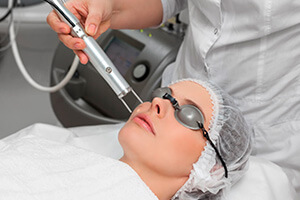 Laser FOTONA São Paulo - Rejuvenescimento e Depilação a Laser